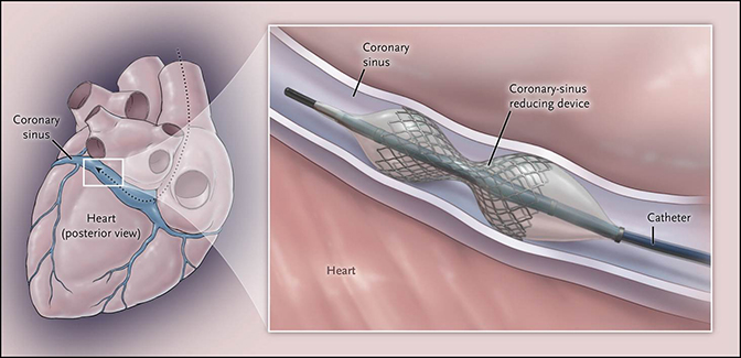 Figure from reference 1.